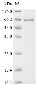 Recombinant Mouse Interleukin-1 receptor-associated kinase 4 (Irak4)