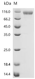Recombinant Macaca fascicularis Integrin beta (ITGB6), partial