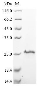 Recombinant Mouse Galectin-1 (Lgals1)