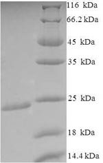 Recombinant Escherichia coli O9:H4 Outer-membrane lipoprotein carrier protein (lolA)