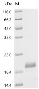 Recombinant Mouse Lymphocyte antigen 6D (Ly6d)