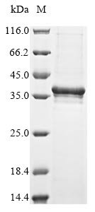 Recombinant Vesicular stomatitis Indiana virus Matrix protein (M)