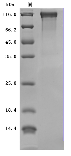 Recombinant Mouse Microtubule-associated protein tau (Mapt) (Active)