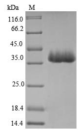 Recombinant Legionella pneumophila Outer membrane protein MIP (mip)