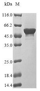 Recombinant Rabies virus Nucleoprotein (N)