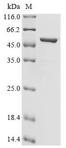 Recombinant Severe acute respiratory syndrome coronavirus 2 Nucleoprotein (N) (R203M,D377Y) (Active)