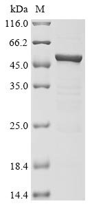 Recombinant Severe acute respiratory syndrome coronavirus 2 Nucleoprotein (N) (D63G,R203M,D377Y) (Active)