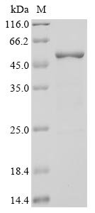 Recombinant Severe acute respiratory syndrome coronavirus 2 Nucleoprotein (N) (P13L) (Active)
