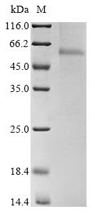 Recombinant Avian infectious bronchitis virus Nucleoprotein (N)