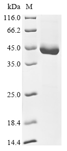 Recombinant Classical swine fever virus Genome polyprotein, partial