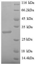 Recombinant Streptomyces avidinii Streptavidin