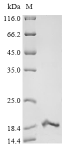 Recombinant Paraphysa scrofa Kappa-theraphotoxin-Ps1b