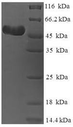 Recombinant Human rhinovirus A serotype 89 Genome polyprotein, partial