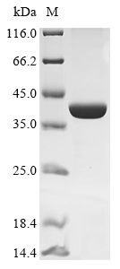 Recombinant Pseudomonas cichorii D-tagatose 3-epimerase
