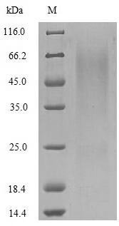 Recombinant Rotavirus A Outer capsid glycoprotein VP7