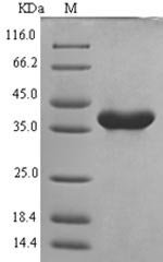 Recombinant Mouse NACHT, LRR and PYD domains-containing protein 3 (Nlrp3), partial