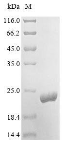 Recombinant Influenza B virus Nuclear export protein (NS)