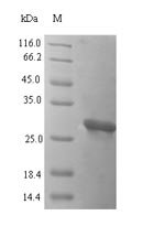 Recombinant Mouse Oncomodulin (Ocm)