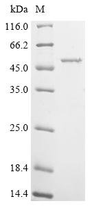 Recombinant Acinetobacter baumannii Outer membrane protein Omp38 (omp38)
