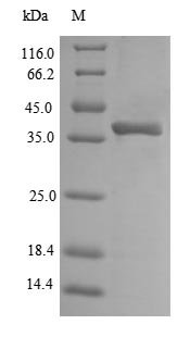 Recombinant Escherichia coli O157:H7 Outer membrane protein A (ompA), partial
