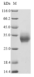 Recombinant Macaca mulatta Oncostatin M (OSM), partial