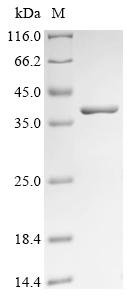 Recombinant Pneumococcus phage Dp-1 Lysin (PAL)
