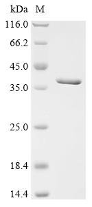Recombinant Anisakis simplex Paramyosin (PARA), partial