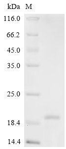 Recombinant Chicken Platelet derived growth factor subunit B (PDGF-B), partial