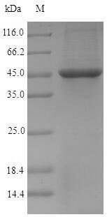 Recombinant Chlamydia trachomatis Probable outer membrane protein PmpD (pmpD), partial