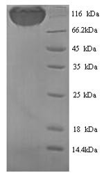Recombinant Rat Podocalyxin (Podxl), partial