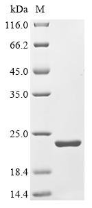 Recombinant Mouse Putative hydrolase RBBP9 (Rbbp9)