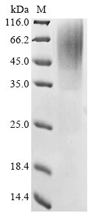 Recombinant Mouse Reticulon-3 (Rtn3), partial