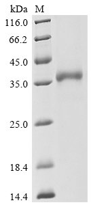 Recombinant Severe acute respiratory syndrome coronavirus 2 Spike glycoprotein (S), partial, Biotinylated