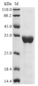 Recombinant Mouse NAD-dependent protein deacetylase sirtuin-3 (Sirt3), partial