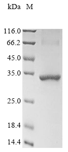 Recombinant Mouse Stanniocalcin-2 (Stc2)