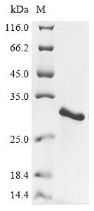 Recombinant Vibrio parahaemolyticus serotype O3:K6 Thermostable direct hemolysin 2 (tdh2)