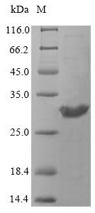 Recombinant Cryptococcus neoformans var. neoformans serotype D Orotate phosphoribosyltransferase (URA5)