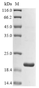 Recombinant Pan troglodytes Histone demethylase UTY (UTY), partial