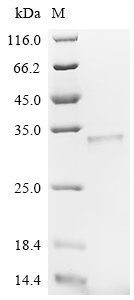 Recombinant Agrobacterium tumefaciens Single-strand DNA-binding protein (virE2), partial