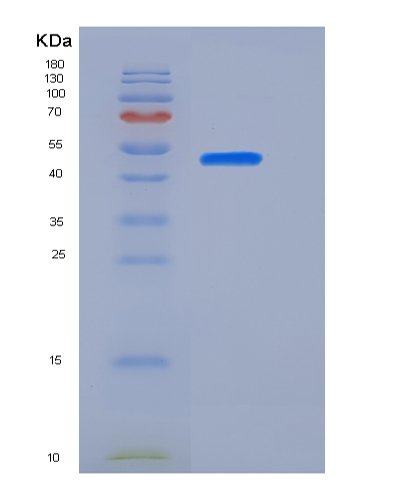 Recombinant Human TNFR1 / CD120a / TNFRSF1A Protein