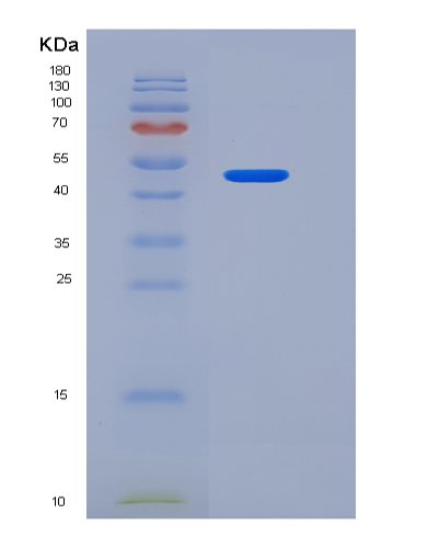Recombinant Mouse TNFR1 / CD120a / TNFRSF1A Protein