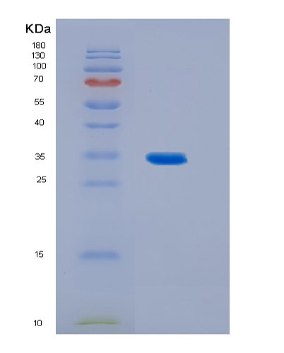 Recombinant Human IL23 23-328aa (IL12B) / 20-189aa (IL23A) Protein