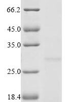 (Tris-Glycine gel) Discontinuous SDS-PAGE (reduced) with 5% enrichment gel and 15% separation gel.