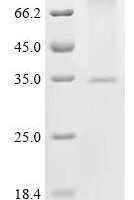 (Tris-Glycine gel) Discontinuous SDS-PAGE (reduced) with 5% enrichment gel and 15% separation gel.
