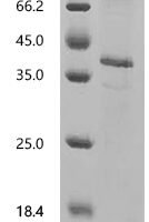 (Tris-Glycine gel) Discontinuous SDS-PAGE (reduced) with 5% enrichment gel and 15% separation gel.