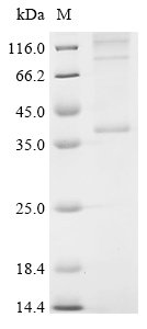 (Tris-Glycine gel) Discontinuous SDS-PAGE (reduced) with 5% enrichment gel and 15% separation gel.