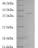 (Tris-Glycine gel) Discontinuous SDS-PAGE (reduced) with 5% enrichment gel and 15% separation gel.