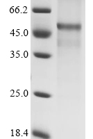 (Tris-Glycine gel) Discontinuous SDS-PAGE (reduced) with 5% enrichment gel and 15% separation gel.