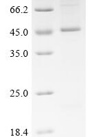 (Tris-Glycine gel) Discontinuous SDS-PAGE (reduced) with 5% enrichment gel and 15% separation gel.