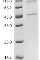 (Tris-Glycine gel) Discontinuous SDS-PAGE (reduced) with 5% enrichment gel and 15% separation gel.
